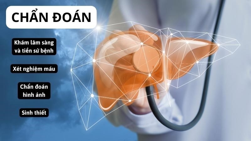Bác sĩ có thể kết hợp thăm khám triệu chứng và các phương pháp xét nghiệm 