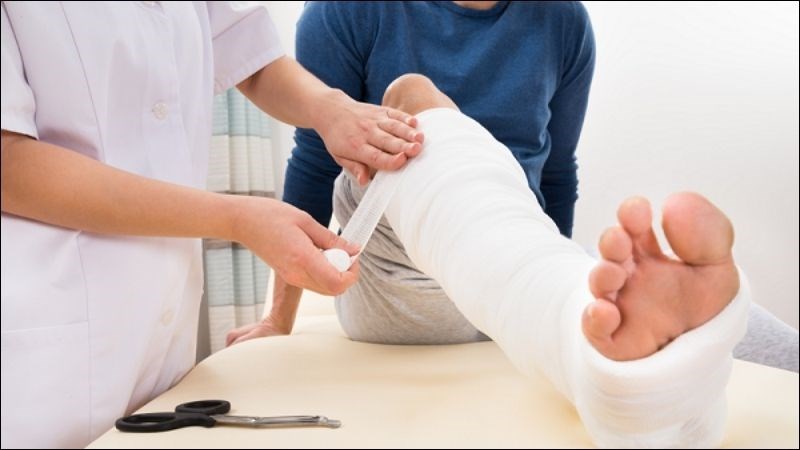 Sử dụng bó bột để cố định chi