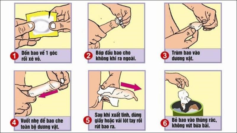 Sử dụng bao cao su khi quan hệ tình dục là cách phòng ngừa chlamydia hiệu quả Sử dụng bao cao su khi quan hệ tình dục là cách phòng ngừa chlamydia hiệu quả