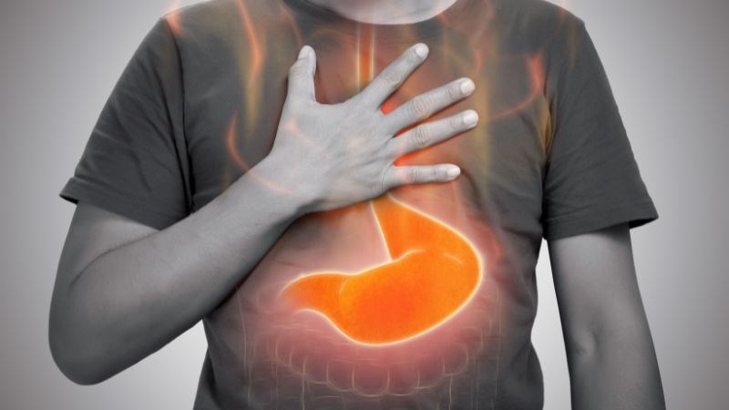 Triệu chứng điển hình của ợ nóng là nóng rát khó chịu vùng ngực