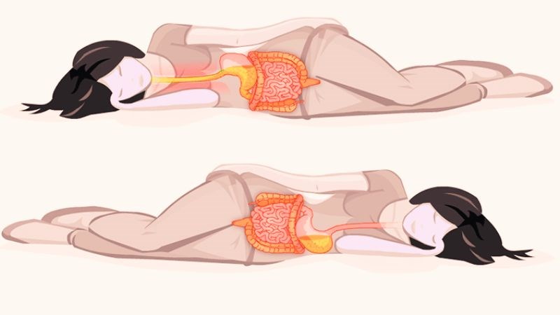Ợ nóng đau hơn khi nằm hoặc cúi xuống