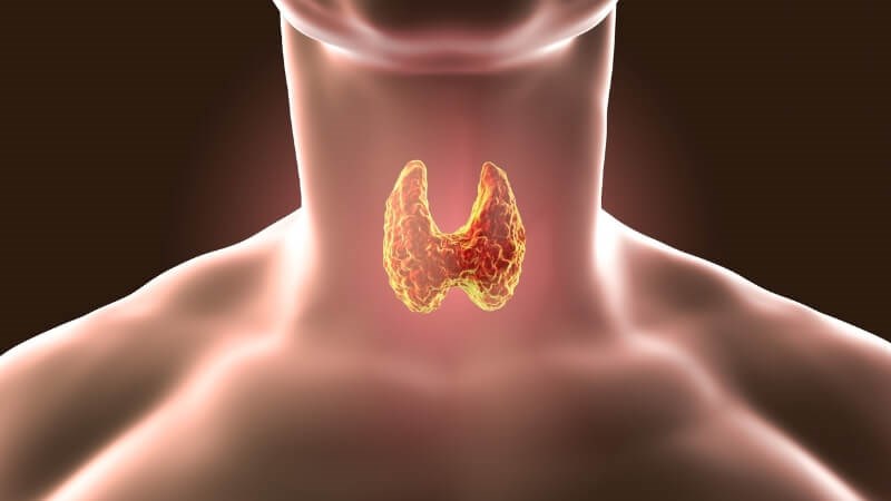 Rối loạn tuyến giáp gây mất cân bằng nội tiết tố và làm lông mọc nhiều