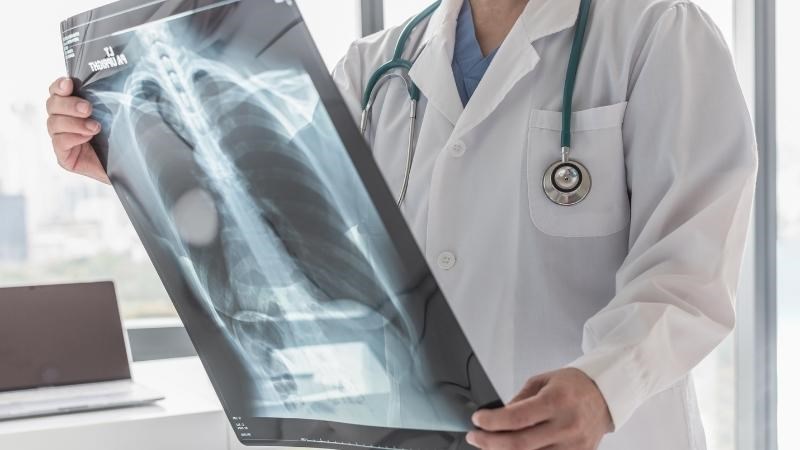 X - quang phổi là tiêu chuẩn vàng để đánh giá tình trạng viêm phổi