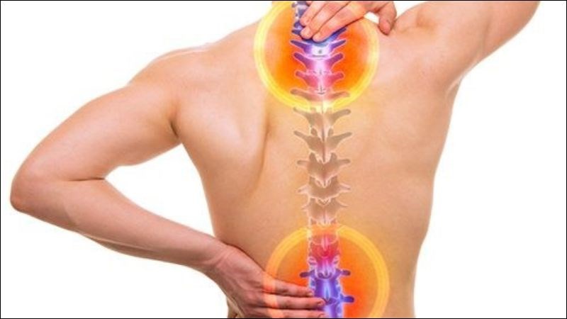 Thoái hóa cột sống là tình trạng cột sống thay đổi cấu trúc và suy giảm chức năng
