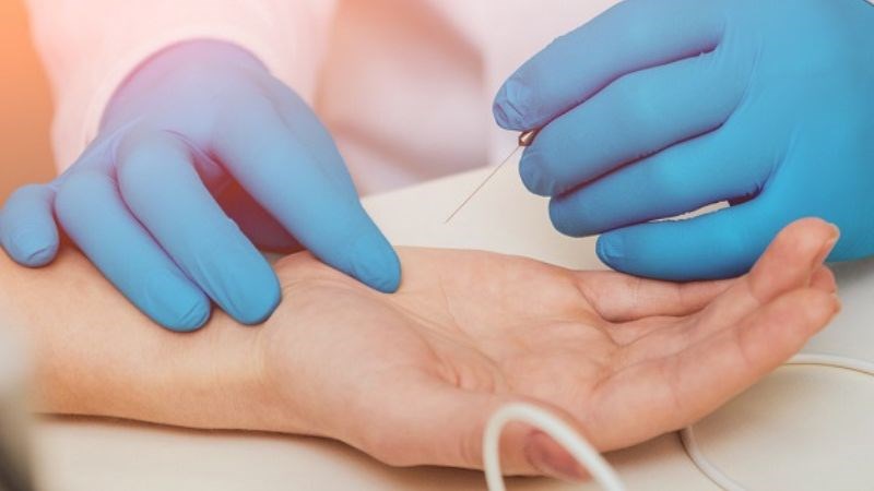 Điện cơ đồ là xét nghiệm nhằm để đánh giá hoạt động của rễ thần kinh