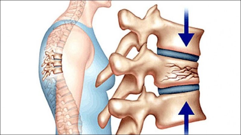 Đau lưng sau chấn thương cột sống nên đến ngay các cơ sở y tế để được điều trị