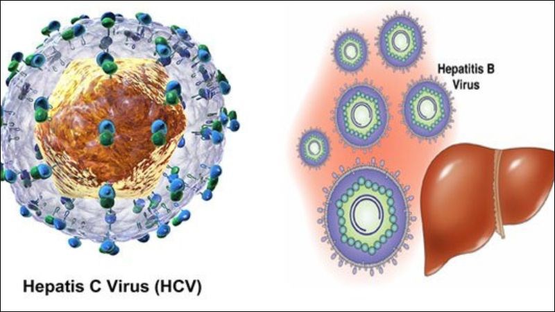 Viêm gan C là tình trạng virus HCV tấn công vào gan gây viêm Viêm gan C là tình trạng virus HCV tấn công vào gan gây viêm