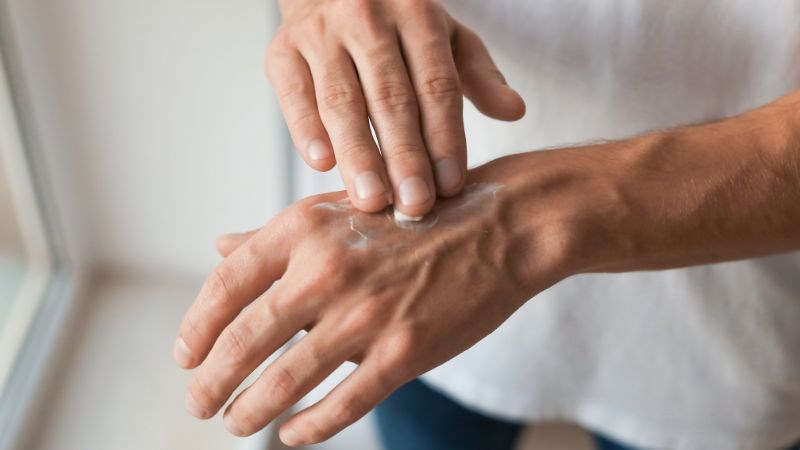 Sử dụng thuốc bôi để giảm tổn thương da do dày sừng ánh sáng