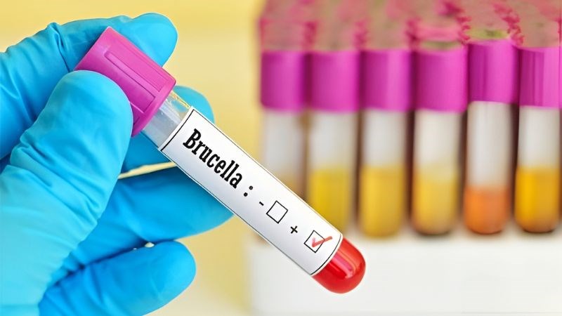 Chẩn đoán bệnh Brucella bao gồm xét nghiệm máu hoặc tủy xương để phát hiện trực khuẩn