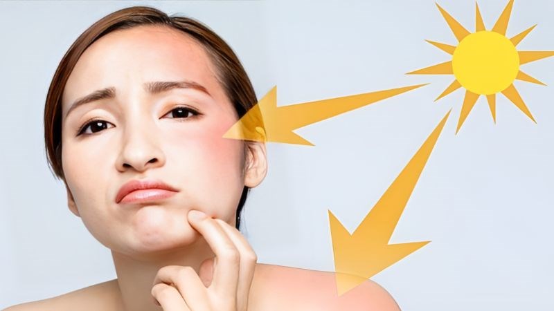 Dày sừng ánh sáng có nguyên nhân xuất phát do tác động kéo dài của ánh sáng mặt trời hoặc tia tử ngoại