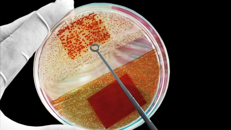 Nuôi cấy phân lập vi khuẩn giúp bác sĩ chẩn đoán hạ cam mềm
