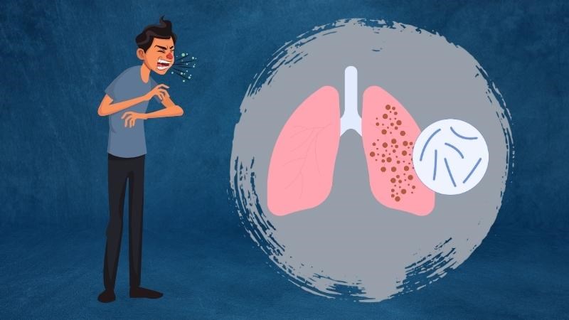 Lao kê là một lao bệnh lao đặc trưng bởi tổn thương có hình dạng giống hạt kê 