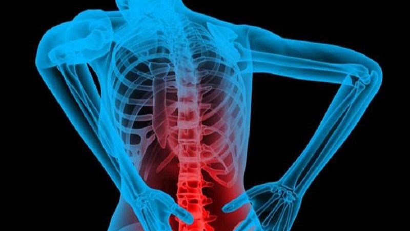 Lao xương là bệnh toàn thân và gây tổn thương lao khu trú ở xương