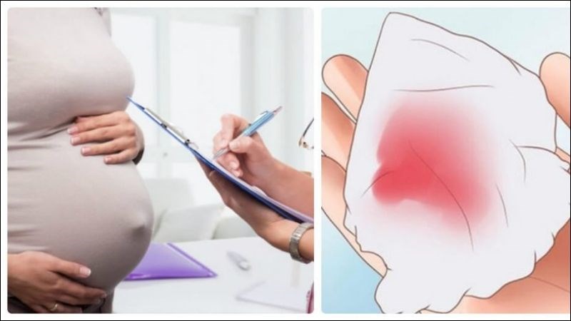 Chảy máu âm đạo sau tuần 20 là một trong những dấu hiệu của nhau tiền đạo