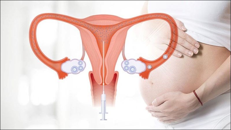 Dùng thụ tinh nhân tạo để tăng khả năng trứng và tinh trùng gặp nhau