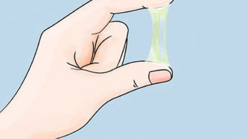 Dấu hiệu có thể gặp của bệnh là dịch tiết âm đạo bất thường