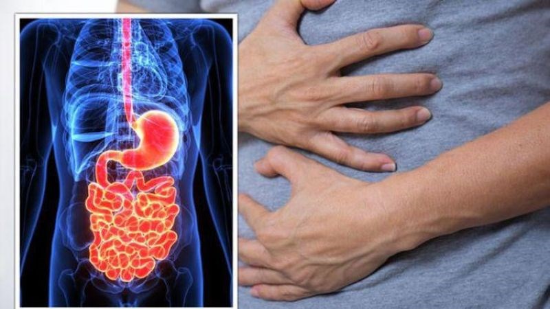 Viêm phúc mạc là tình trạng lớp thanh mạc bao quanh ổ bụng bị viêm