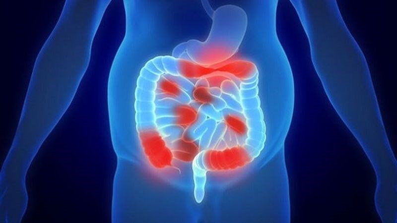 Viêm phúc mạc có thể gây nên tình trạng hoại tử ruột