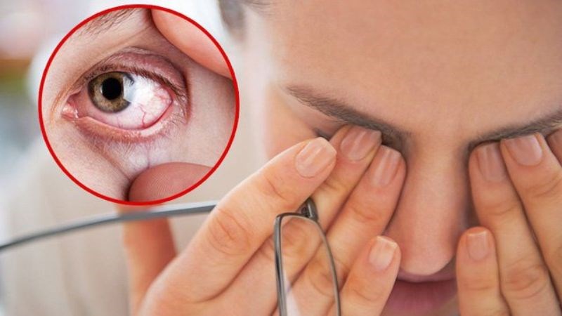Co giật mắt có thể gây kích ứng mắt