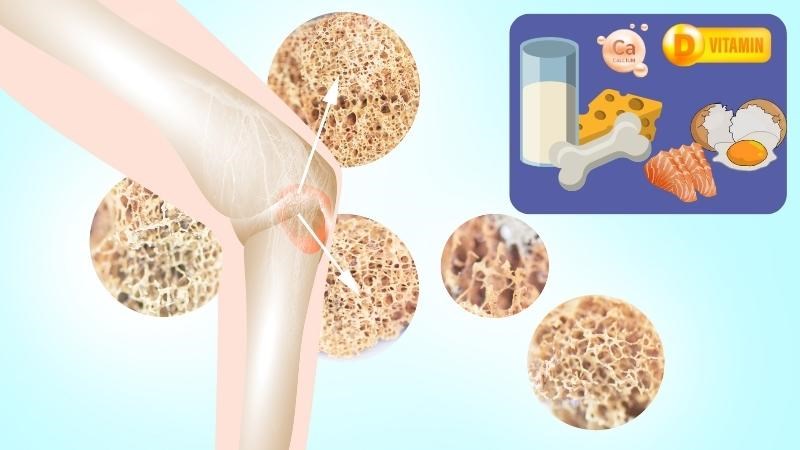 Bổ sung canxi và vitamin D để giúp xương chắc khỏe hơn Bổ sung canxi và vitamin D để giúp xương chắc khỏe hơn