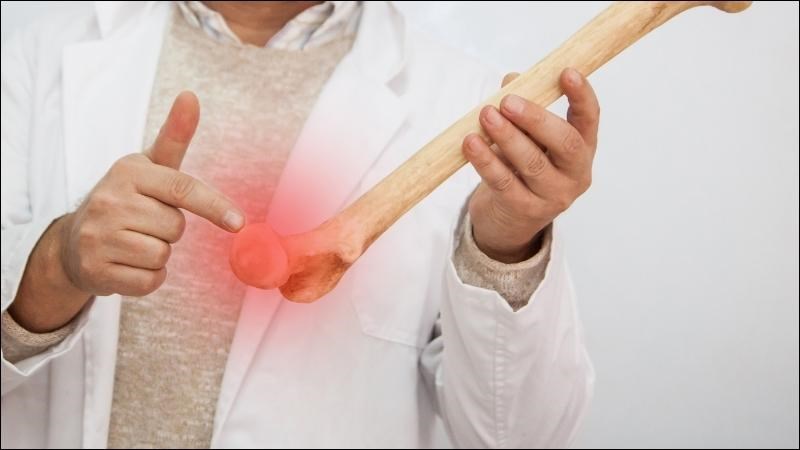 Ung thư xương rất hiếm khi xảy ra Ung thư xương rất hiếm khi xảy ra