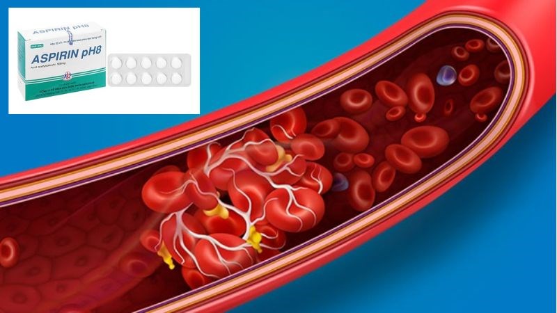 Thuốc aspirin giúp ngăn chặn quá trình hình thành huyết khối