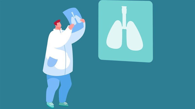 X-quang ngực giúp bác sĩ kiểm tra các bất thường tại phổi