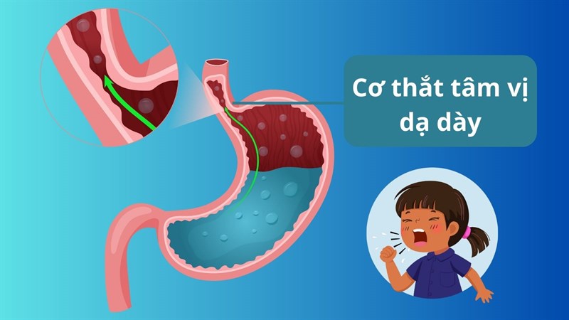 Cơ thắt tâm vị trẻ em còn yếu nên dễ bị trào ngược dạ dày