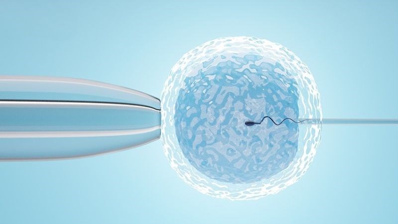 Một số nghiên cứu cho thấy có mối liên quan giữa IVF và lỗ tiểu lệch thấp
