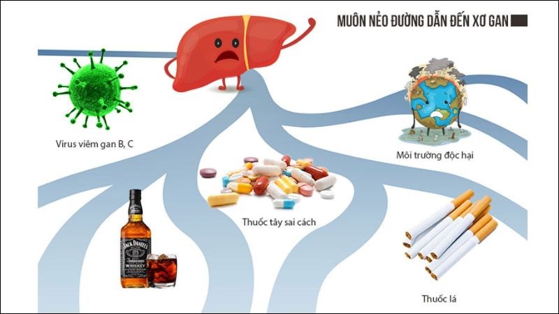 Một số nguyên nhân dẫn tới xơ gan
