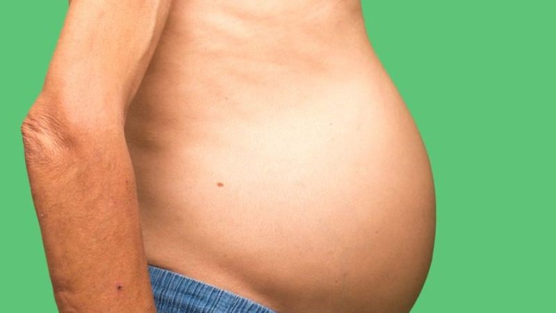 Giai đoạn muộn của suy gan có thể xuất hiện cổ chướng