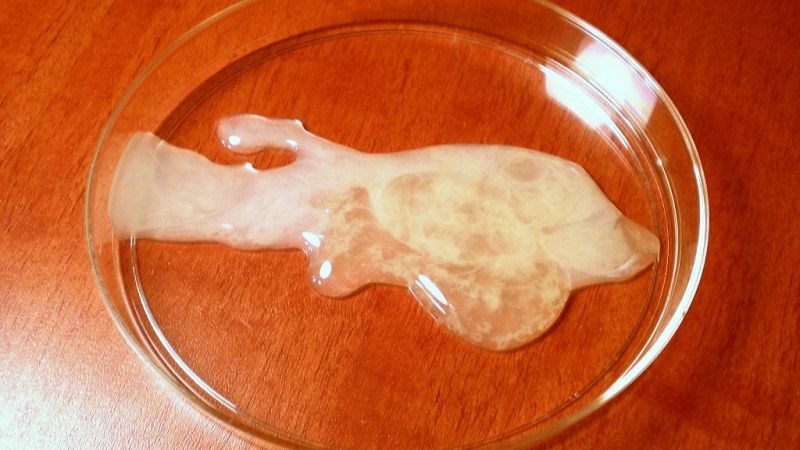 Một nguyên nhân thường gặp khiến tinh dịch có màu vàng là do có lẫn nước tiểu