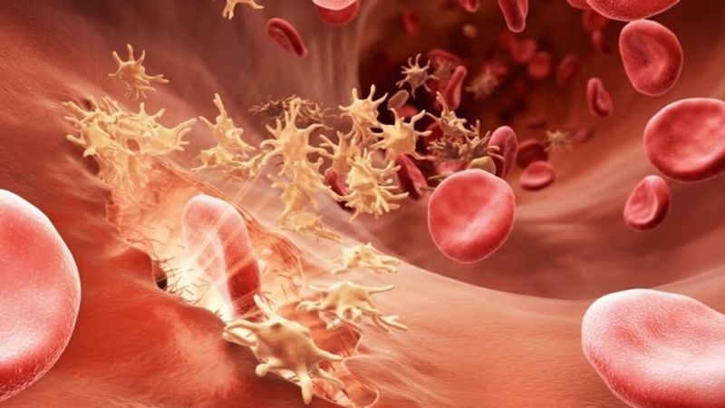 Rối loạn đông máu có thể gây xuất tinh ra máu