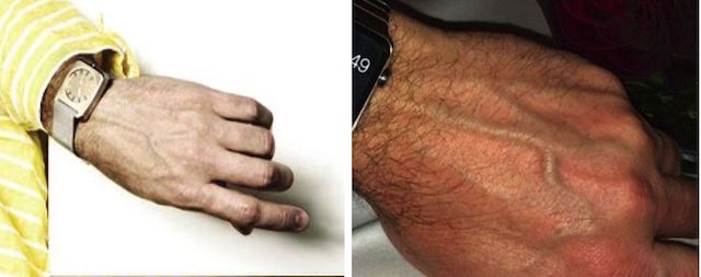 Cánh tay bí ẩn và Apple Watch