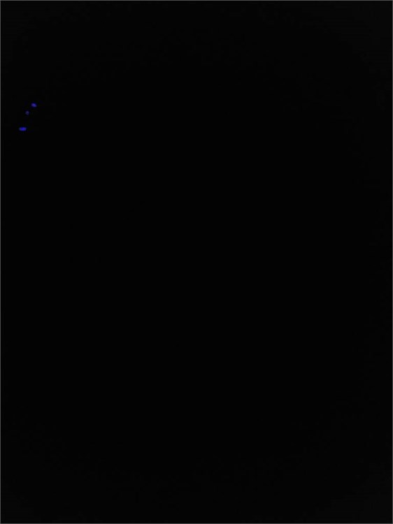 Một số bức ảnh khác cho thấy có các đốm màu lạ từ ảnh chụp camera trước Galaxy S6 1 Một số bức ảnh khác cho thấy có các đốm màu lạ từ ảnh chụp camera trước Galaxy S6 1