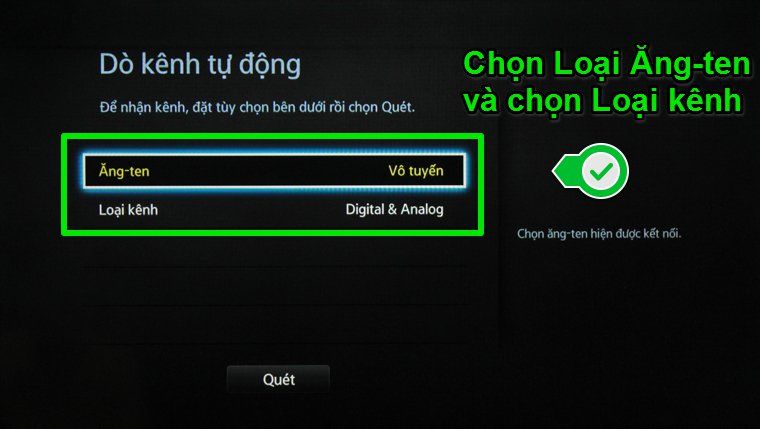 Giao diện tùy chọn của dò kênh tự động