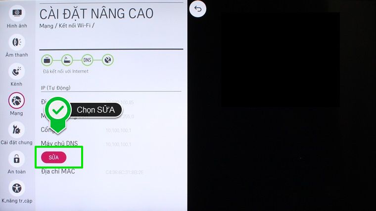 Chọn SỬA Cách cài đặt IP và DNS mạng cho Smart tivi LG hệ điều hành WebOS > Chọn SỬA