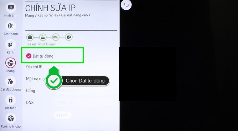 Cài đặt IP tự động Cách cài đặt IP và DNS mạng cho Smart tivi LG hệ điều hành WebOS > Cài đặt IP tự động