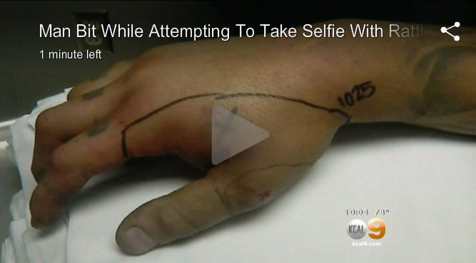 Tự sướng với rắn bị cắn