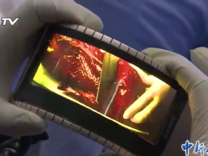 Smartphone uốn dẻo Smartphone uốn dẻo