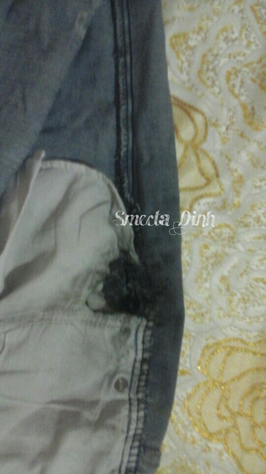 Do máy đang nằm trong túi quần tại thời điểm vụ nổ xảy ra, nó đã khiến cho chiếc quần bị cháy Do máy đang nằm trong túi quần tại thời điểm vụ nổ xảy ra, nó đã khiến cho chiếc quần bị cháy