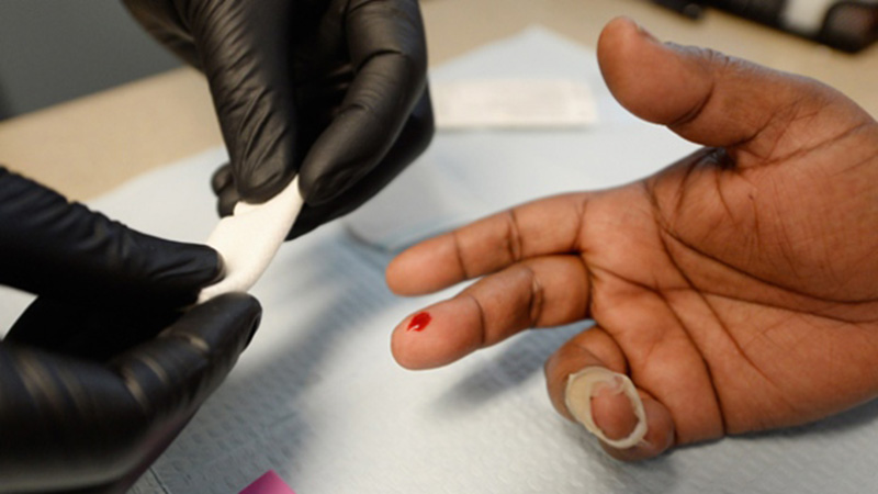 Hiện tại, xét nghiệm thường đòi hỏi thiết bị đắt tiền và phức tạp cũng như có thể mất một vài ngày để có kết quả.