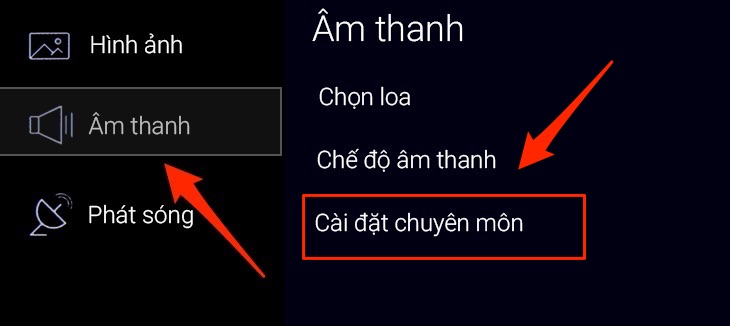 Chọn Cài đặt chuyên môn