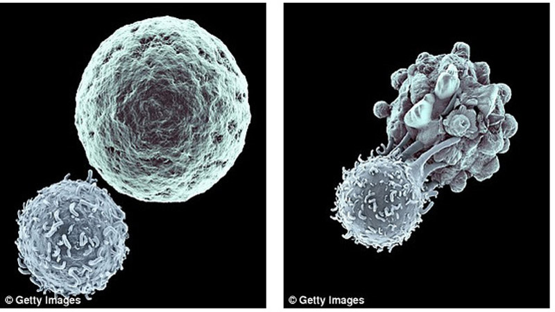 chữa ung thư bằng tế bào miễn dịch biến đổi gen