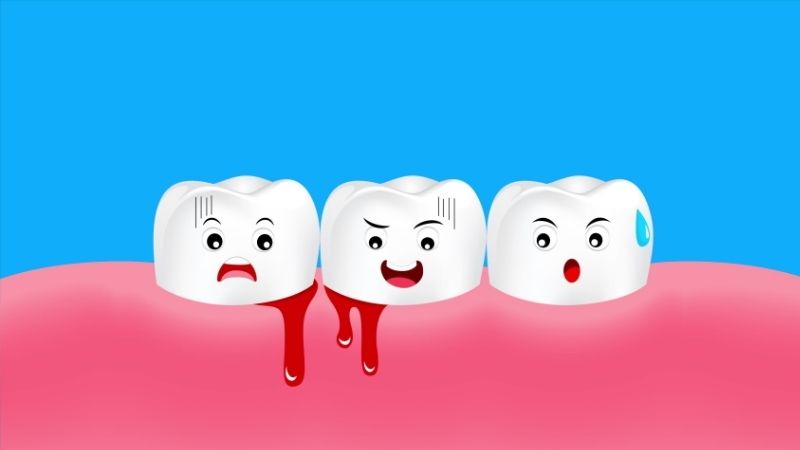 Chảy máu chân răng là dấu hiệu của thiếu vitamin C