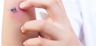 Cách tránh muỗi đốt dễ dàng và hiệu quả