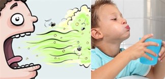Cách tự làm nước súc miệng trị trẻ bị hôi miệng