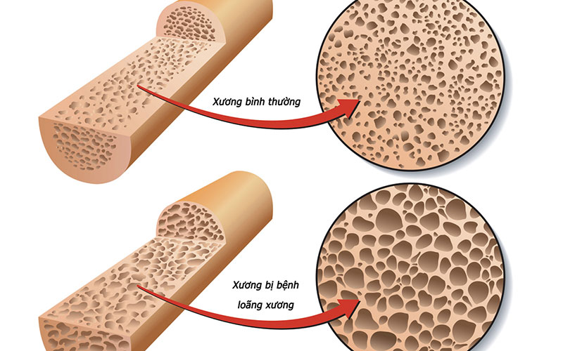 canxi đóng vai trò như thế nào trong cơ thể