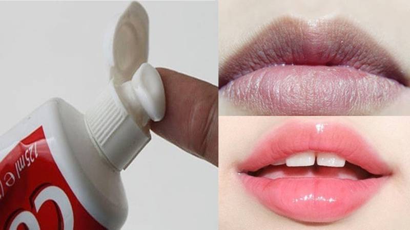 6 cách trị thâm môi bằng kem đánh răng dứt điểm tại nhà- Hiệu quả nhanh