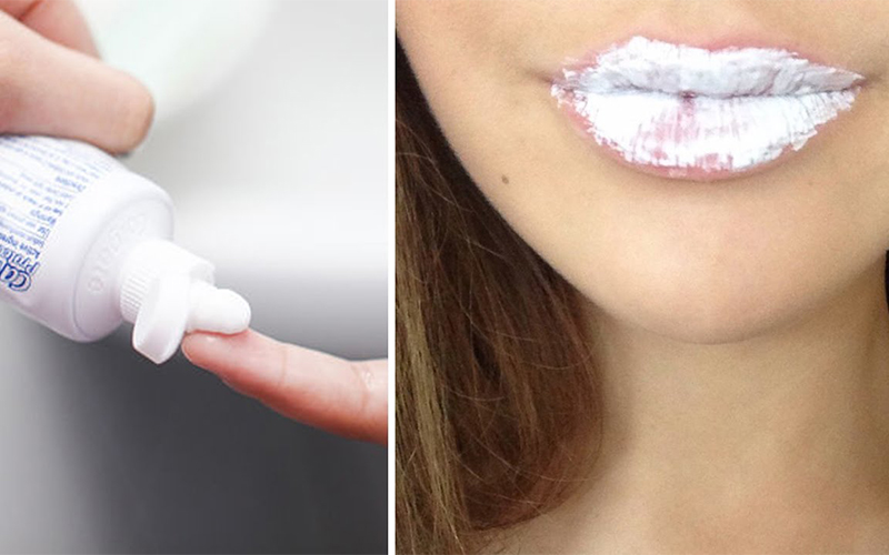 Cách trị thâm môi bằng kem đánh răng có thực sự hiệu quả